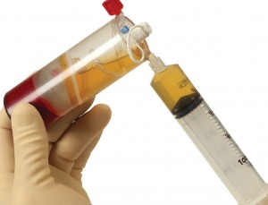 Syringe filled with platelet-rich plasma (PRP)