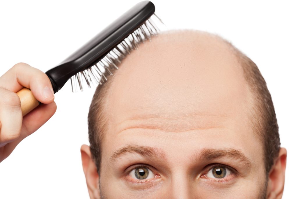 hair loss myths