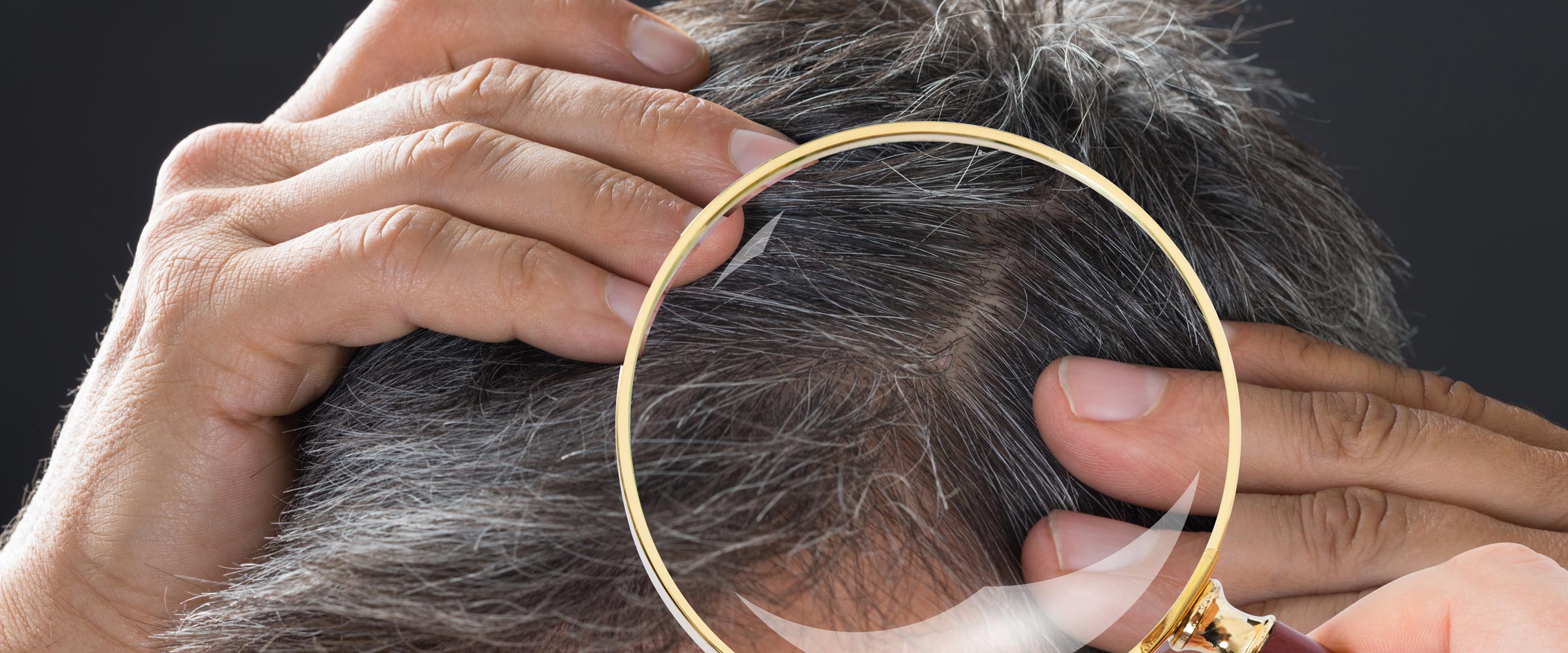 Hair Loss vs. Hair Shedding - Miami Hair Institute