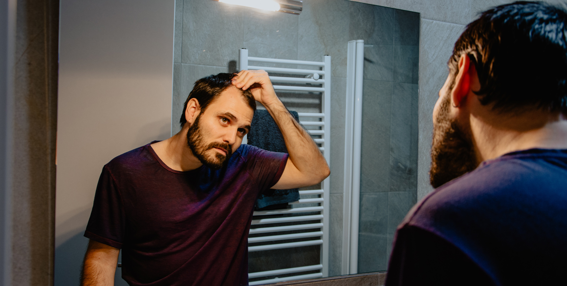 Can You See Your Hair Loss Future When You See Your Family?