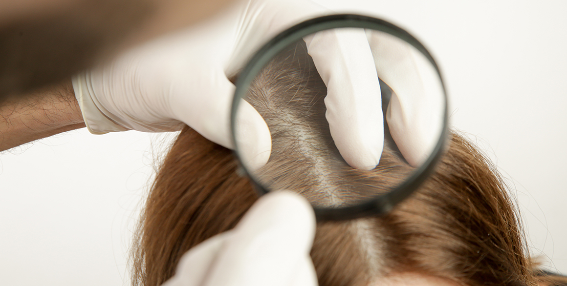 What Happens At An Initial Hair Loss Evaluation